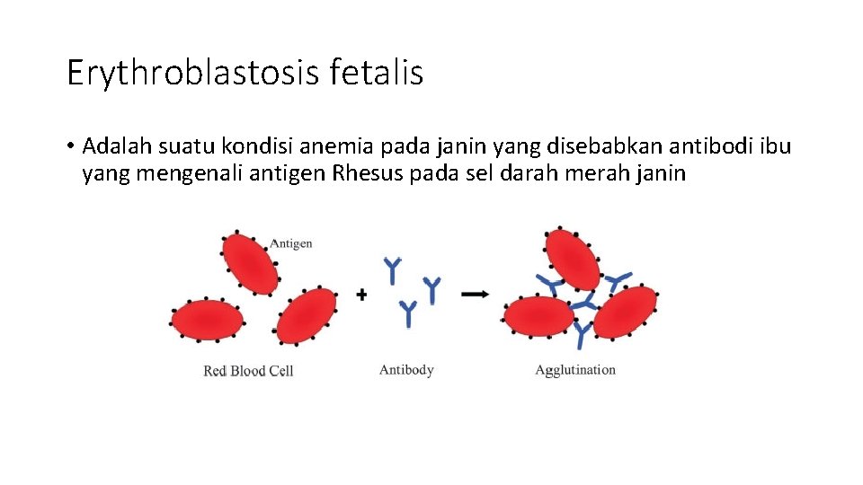Erythroblastosis fetalis • Adalah suatu kondisi anemia pada janin yang disebabkan antibodi ibu yang
