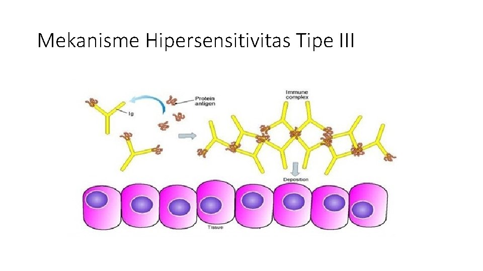 Mekanisme Hipersensitivitas Tipe III 