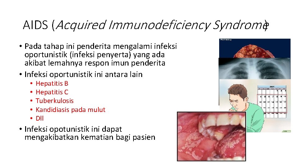 AIDS (Acquired Immunodeficiency Syndrome) • Pada tahap ini penderita mengalami infeksi oportunistik (infeksi penyerta)