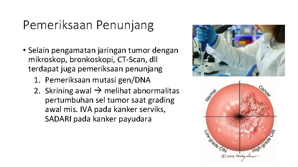 Pemeriksaan Penunjang • Selain pengamatan jaringan tumor dengan mikroskop, bronkoskopi, CT-Scan, dll terdapat juga