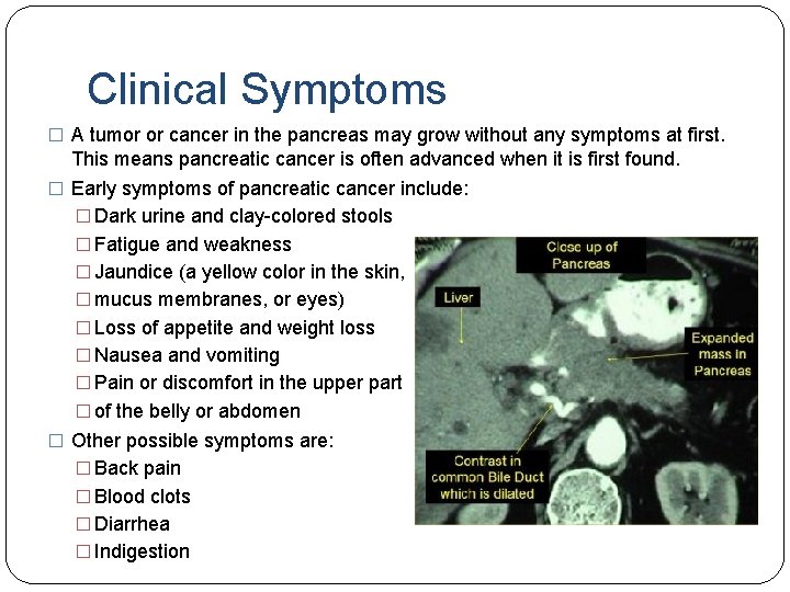 Clinical Symptoms � A tumor or cancer in the pancreas may grow without any