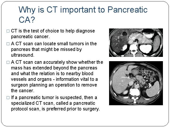 Why is CT important to Pancreatic CA? � CT is the test of choice