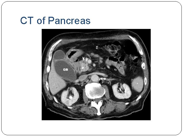 CT of Pancreas 