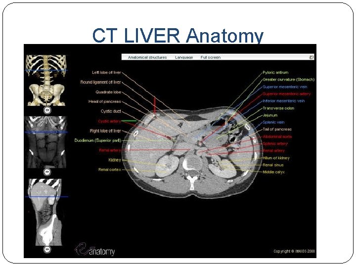 CT LIVER Anatomy 