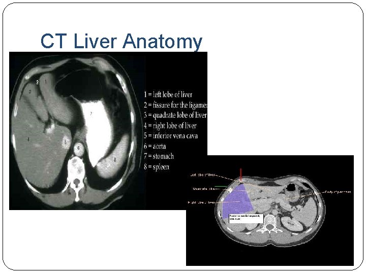 CT Liver Anatomy 