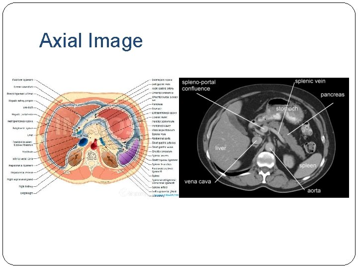 Axial Image 
