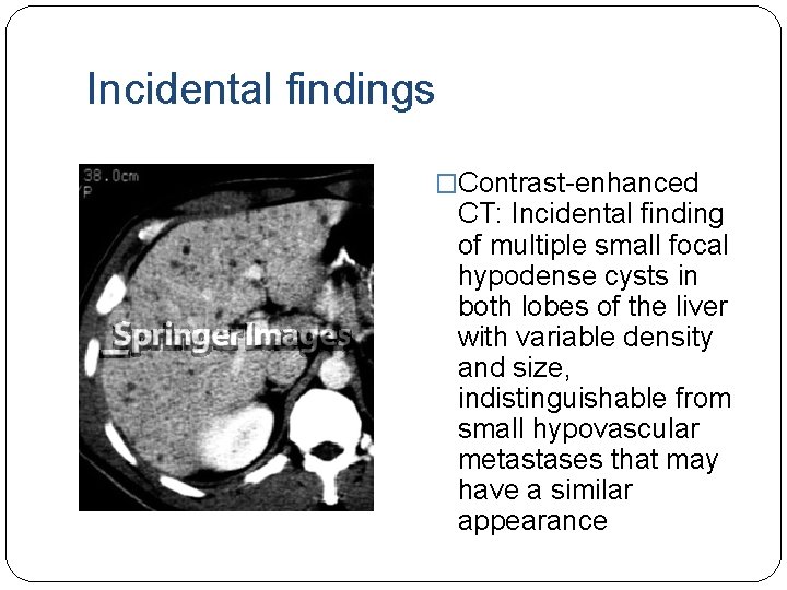 Incidental findings �Contrast-enhanced CT: Incidental finding of multiple small focal hypodense cysts in both
