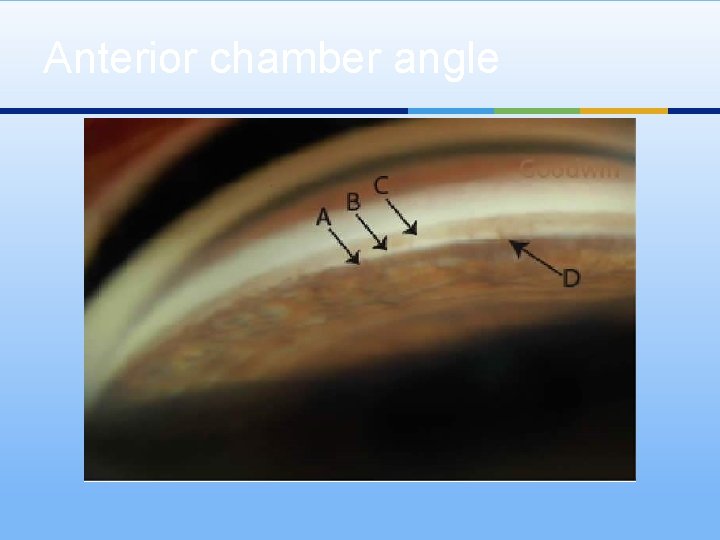 Anterior chamber angle 