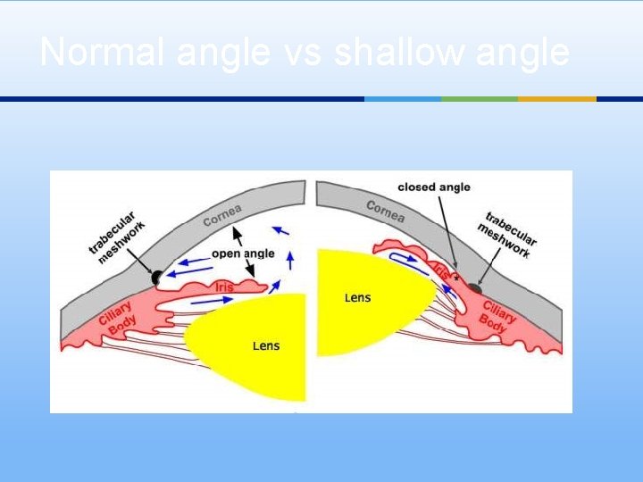 Normal angle vs shallow angle 