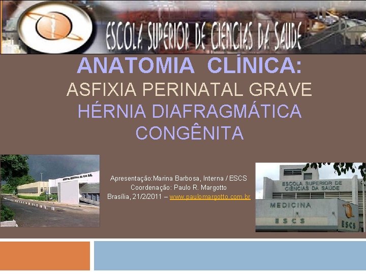 ANATOMIA CLÍNICA: ASFIXIA PERINATAL GRAVE HÉRNIA DIAFRAGMÁTICA CONGÊNITA Apresentação: Marina Barbosa, Interna / ESCS