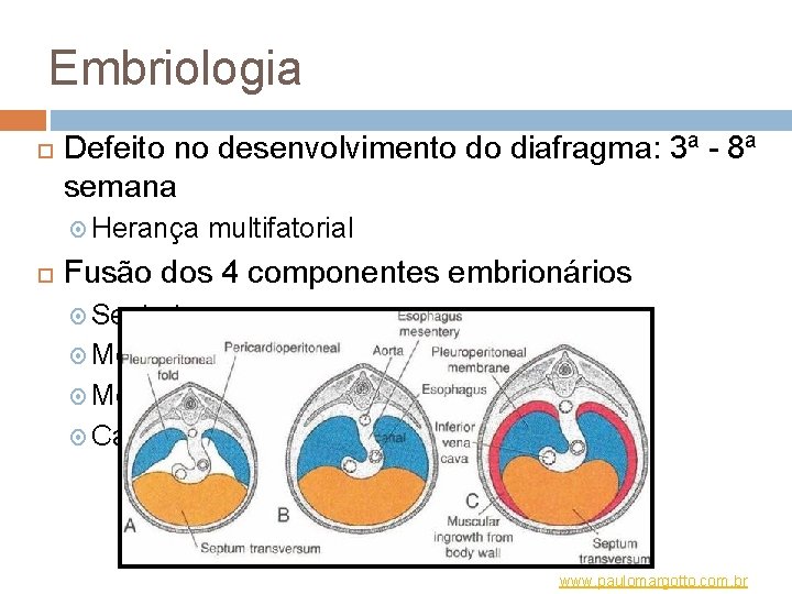 Embriologia Defeito no desenvolvimento do diafragma: 3ª - 8ª semana Herança multifatorial Fusão dos