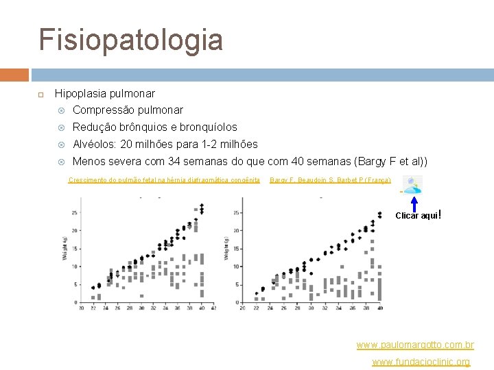 Fisiopatologia Hipoplasia pulmonar Compressão pulmonar Redução brônquios e bronquíolos Alvéolos: 20 milhões para 1