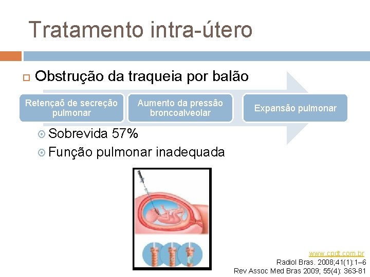 Tratamento intra-útero Obstrução da traqueia por balão Retençaõ de secreção pulmonar Aumento da pressão