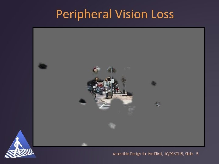 Peripheral Vision Loss Accessible Design for the Blind, 10/29/2015, Slide 5 