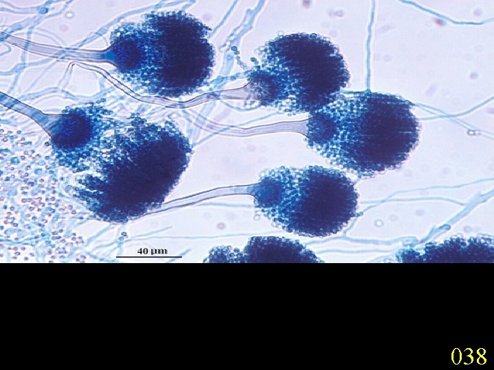 Microscopic morphology of Aspergillus fumigatus showing typical columnar, uniseriate conidial heads. Conidiophores are short,