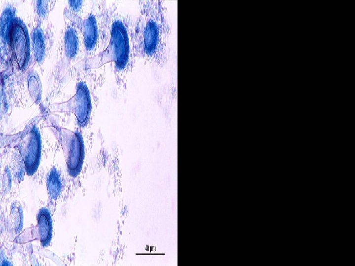 Microscopic morphology of Aspergillus fumigatus showing typical columnar, uniseriate conidial heads. Conidiophores are short,