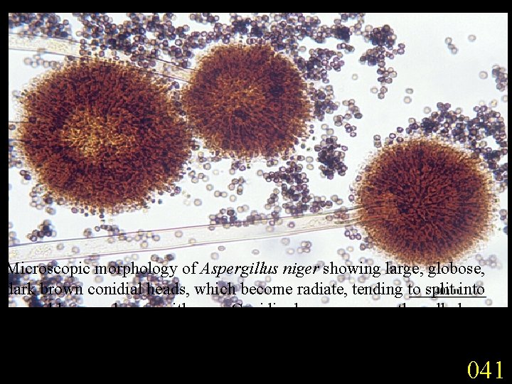 Microscopic morphology of Aspergillus niger showing large, globose, dark brown conidial heads, which become