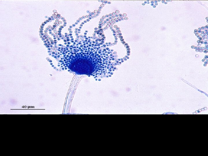 Microscopic morphology of Aspergillus flavus. Conidial heads are typically radiate, later splitting to form