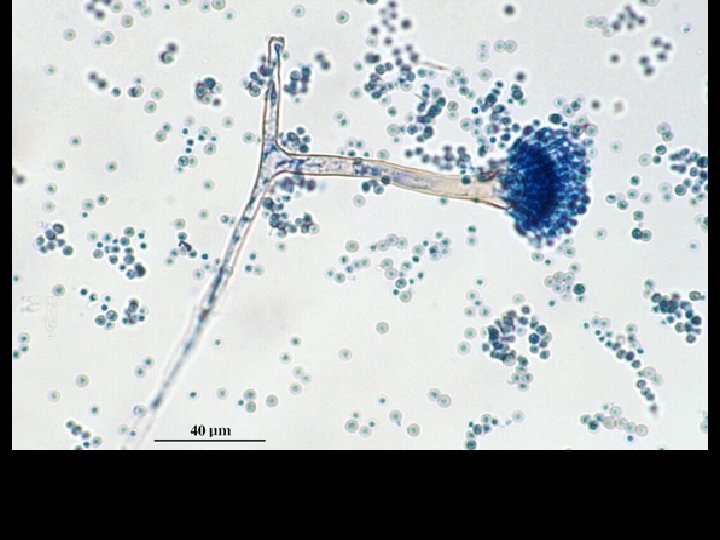 Microscopic morphology of Aspergillus nidulans. Conidial heads are short columnar and biseriate. Conidiophores are