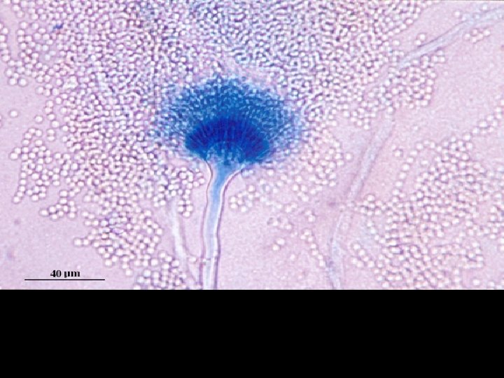 Conidial head of Aspergillus terreus. Conidial heads are compact, columnar and biseriate. Conidiophores are