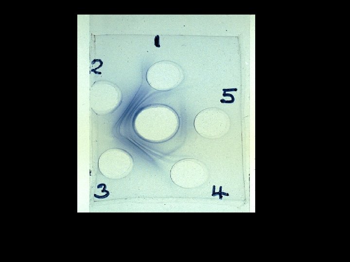 Immunodiffusion test showing precipitins against Aspergillus. 