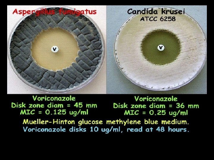 Antifungal susceptibility disk test showing the in vitro activity of voriconazole against Aspergillus fumigatus