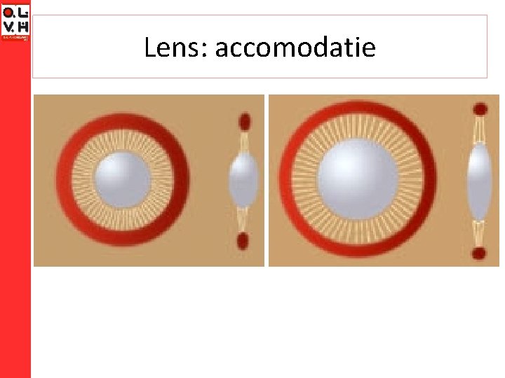 Lens: accomodatie 