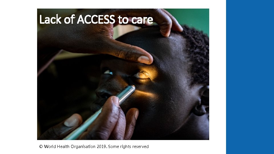 Lack of ACCESS to care © World Health Organisation 2019. Some rights reserved 