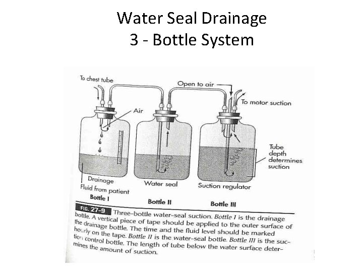 Water Seal Drainage 3 - Bottle System 