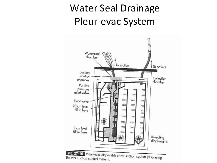 Water Seal Drainage Pleur-evac System 