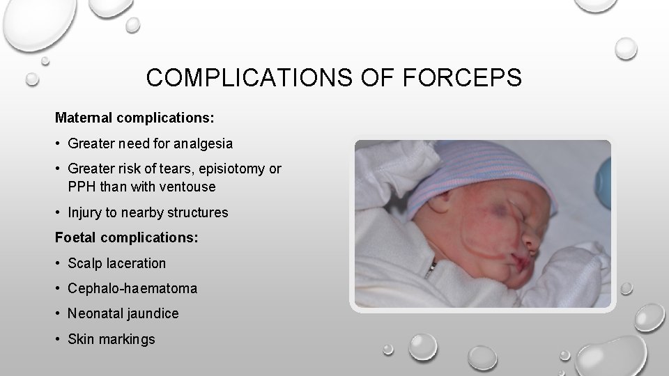 COMPLICATIONS OF FORCEPS Maternal complications: • Greater need for analgesia • Greater risk of