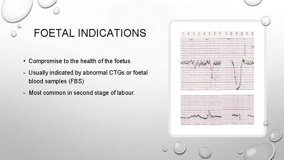 FOETAL INDICATIONS • Compromise to the health of the foetus - Usually indicated by