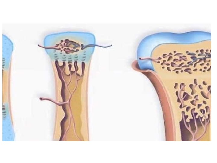 Bone Formation Video 