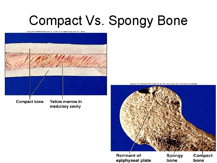 Compact Vs. Spongy Bone Compact Vs. Spongy Bone