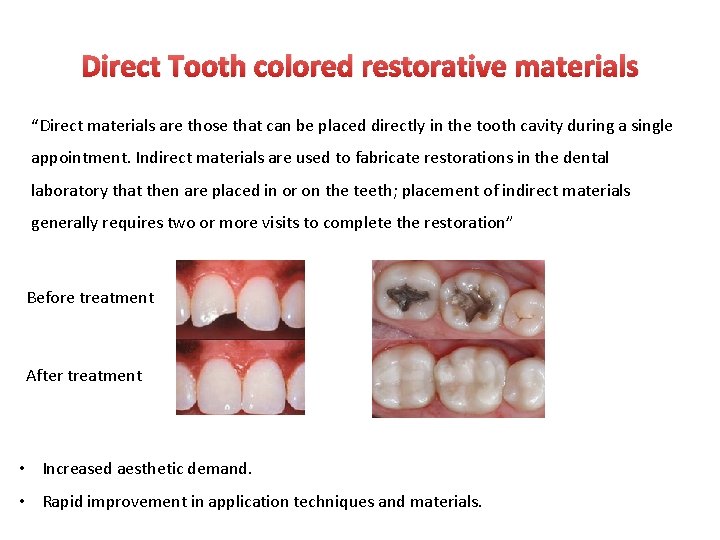 Direct Tooth colored restorative materials “Direct materials are those that can be placed directly