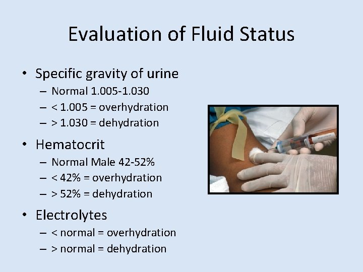 Evaluation of Fluid Status • Specific gravity of urine – Normal 1. 005 -1.