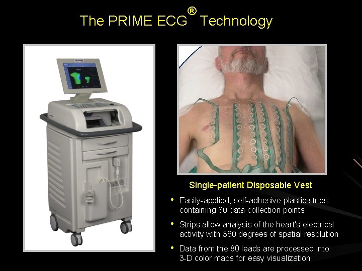 ® The PRIME ECG Technology Single-patient Disposable Vest • Easily-applied, self-adhesive plastic strips containing