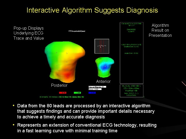Interactive Algorithm Suggests Diagnosis Algorithm Result on Presentation Pop-up Displays Underlying ECG Trace and