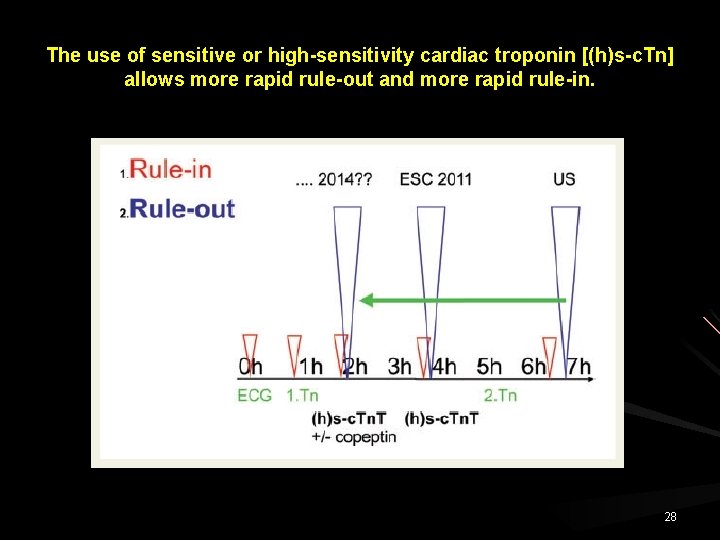 The use of sensitive or high-sensitivity cardiac troponin [(h)s-c. Tn] allows more rapid rule-out