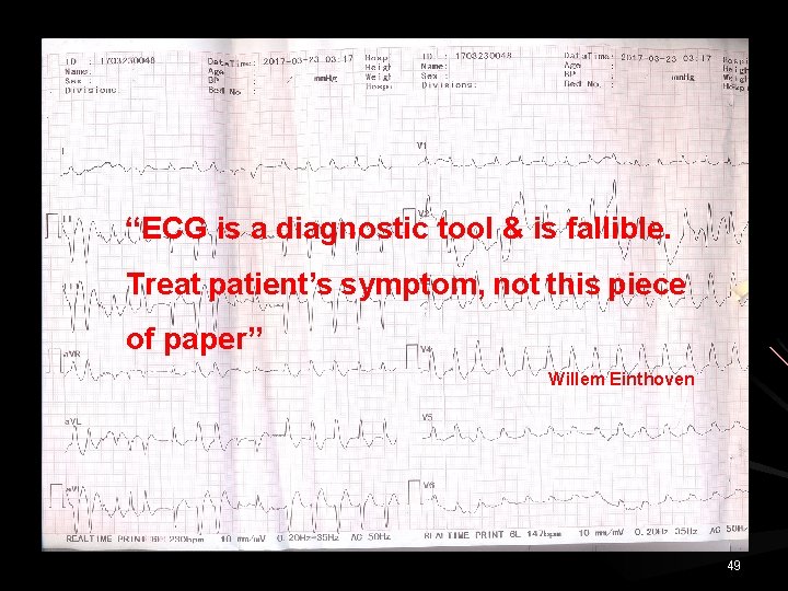 “ECG is a diagnostic tool & is fallible. Treat patient’s symptom, not this piece
