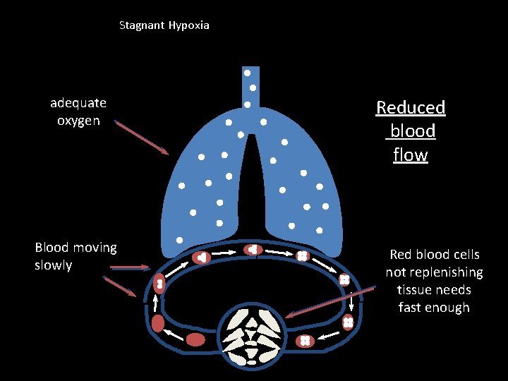 Stagnant Hypoxia adequate oxygen Blood moving slowly Reduced blood flow Red blood cells not