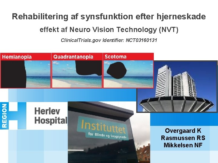Rehabilitering af synsfunktion efter hjerneskade effekt af Neuro Vision Technology (NVT) Clinical. Trials. gov
