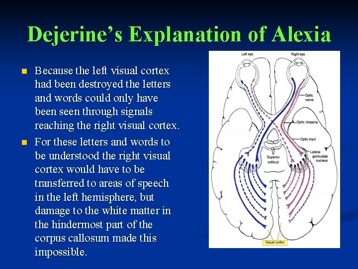 Dejerine’s Explanation of Alexia n n Because the left visual cortex had been destroyed