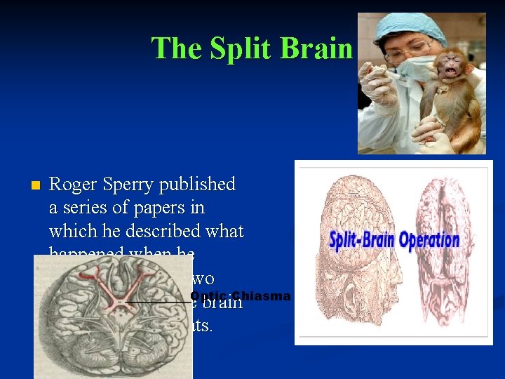The Split Brain n Roger Sperry published a series of papers in which he