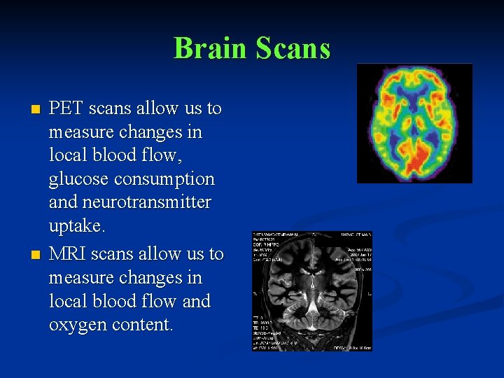 Brain Scans n n PET scans allow us to measure changes in local blood