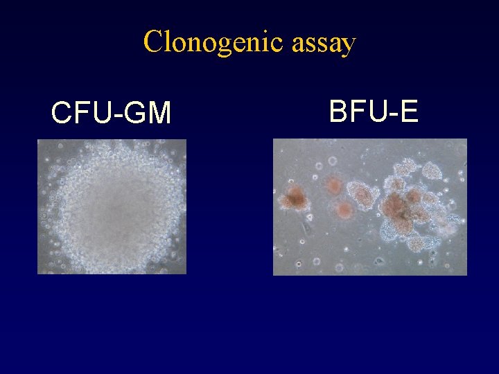 Clonogenic assay CFU-GM BFU-E 