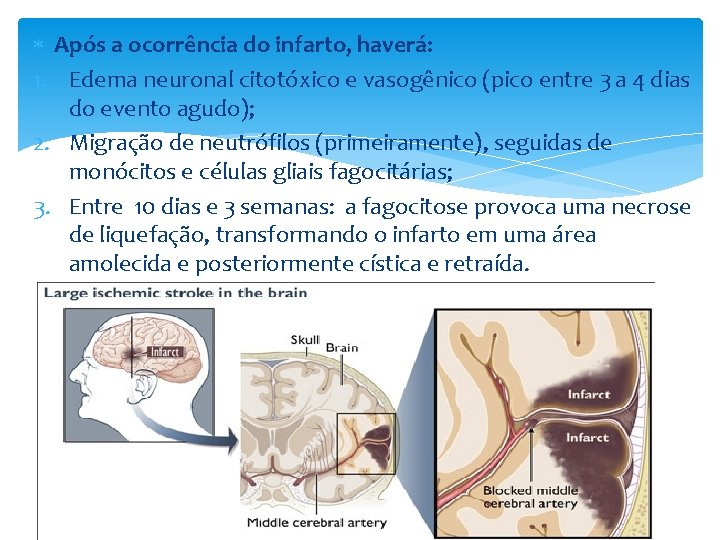  Após a ocorrência do infarto, haverá: 1. Edema neuronal citotóxico e vasogênico (pico