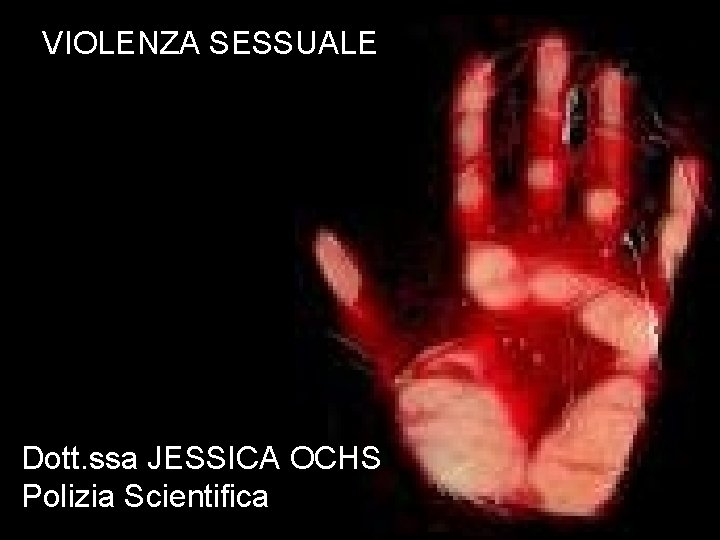 VIOLENZA SESSUALE Dott. ssa JESSICA OCHS Polizia Scientifica 