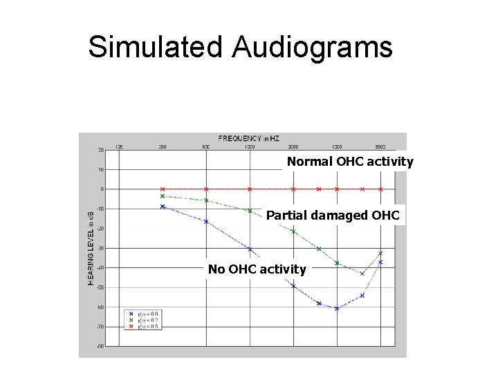 Simulated Audiograms Normal OHC activity Partial damaged OHC No OHC activity 
