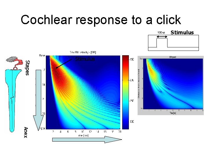 Cochlear response to a click 100 us Stapes Stimulus Apex 